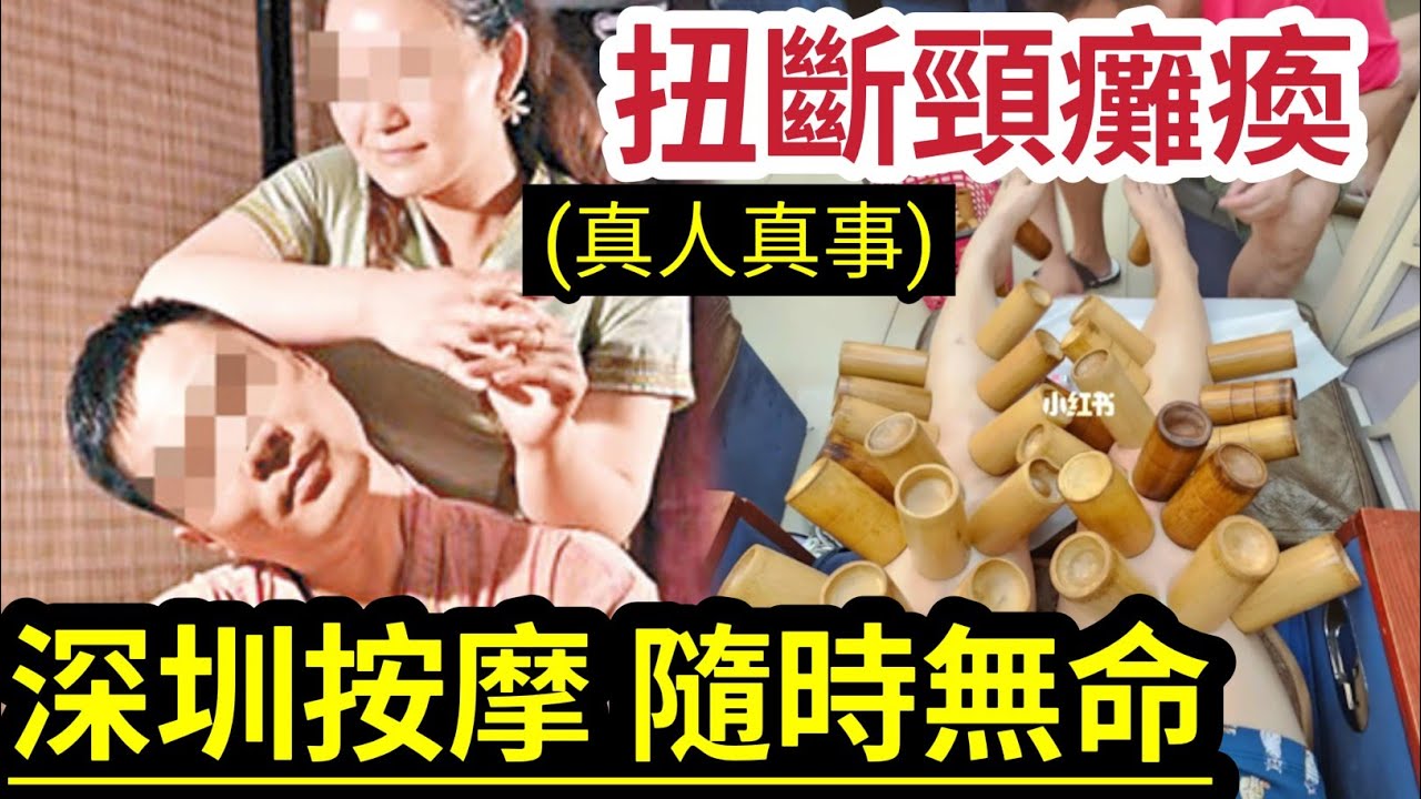 貪平送命！港女「深圳按摩」按傷右肩頸「恐半身不逐」拔火罐「致脫皮！」按摩高危「各大部位」你要知！扭頸即見效「變全身癱瘓」抱憾終生！