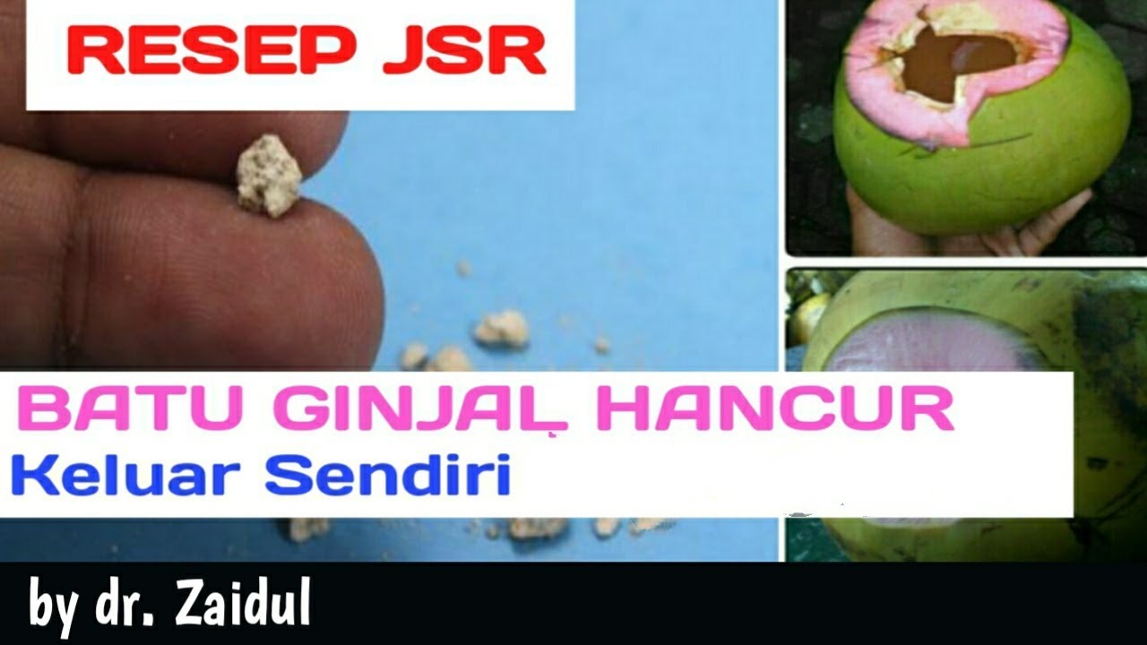 RESEP JSR - CARA MENGOBATI BATU GINJAL SECARA ALAMI 
