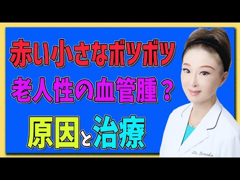 【血管腫】赤い小さなポツポツは老人性の血管腫？原因と治療法