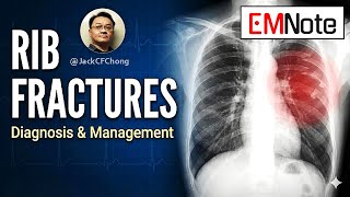 Rib fractures and pulmonary contusions