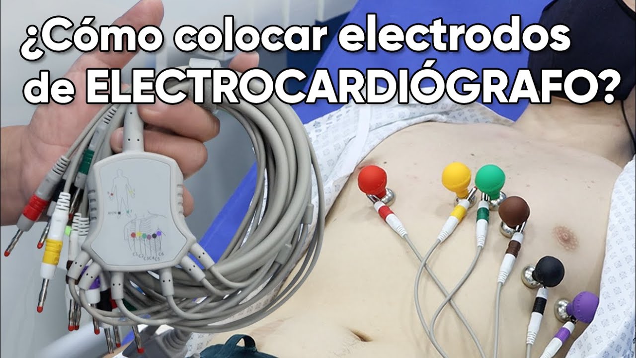 ¿Cómo se colocan los Electrodos del Electrocardiograma?