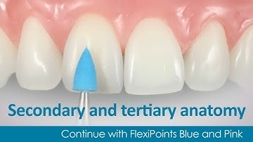 Polychromatic Direct Veneer with Dr. Newton Fahl