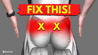 How to Fix SI Joint Pain in 30 SECONDS