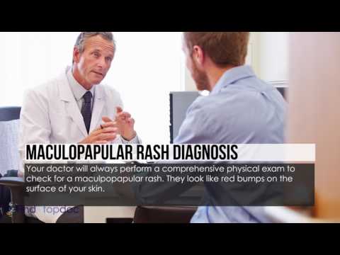 What Is a Maculopapular Rash?