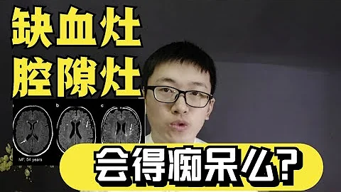 发现脑缺血腔隙灶、白质高信号，会得老年痴呆？医学博士答疑 - 天天要闻