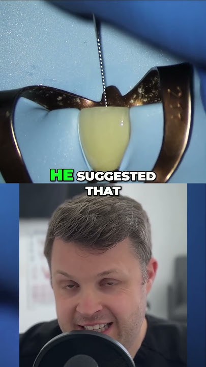 debate-decoded-size-10-vs-size-15-for-root-canal-youtube