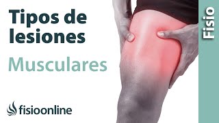 Tipos o grados de LESIONES MUSCULARES y su tratamiento y recuperación
