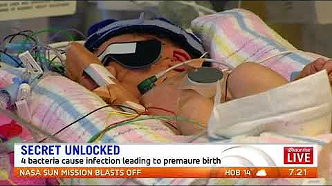 Sunrise: Baby breakthrough bacteria main cause of premature births