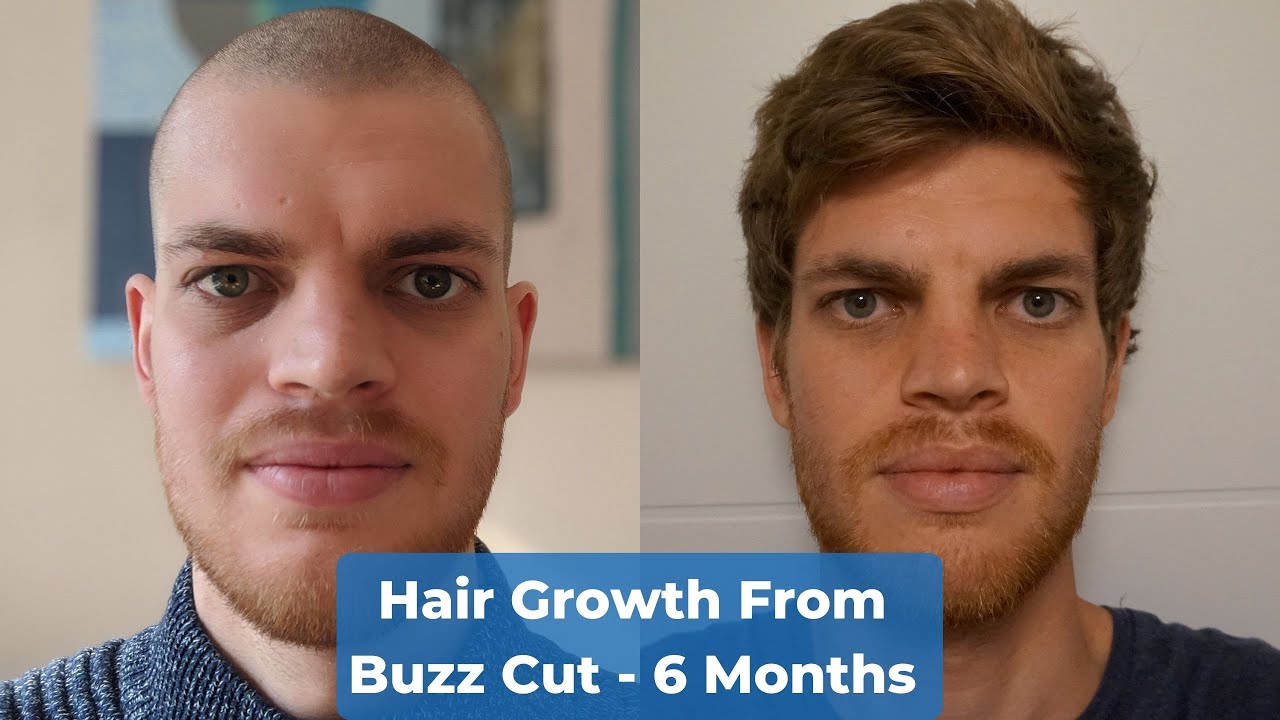 Hair Growth Time Lapse 6 Months - From Buzz Cut - thptnganamst.edu.vn
