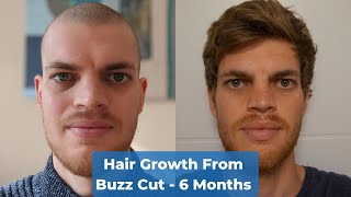 Hair Growth Time Lapse 6 Months - From Buzz Cut