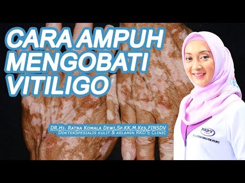 Video: 7 Salah Tanggapan Mengenai Vitiligo