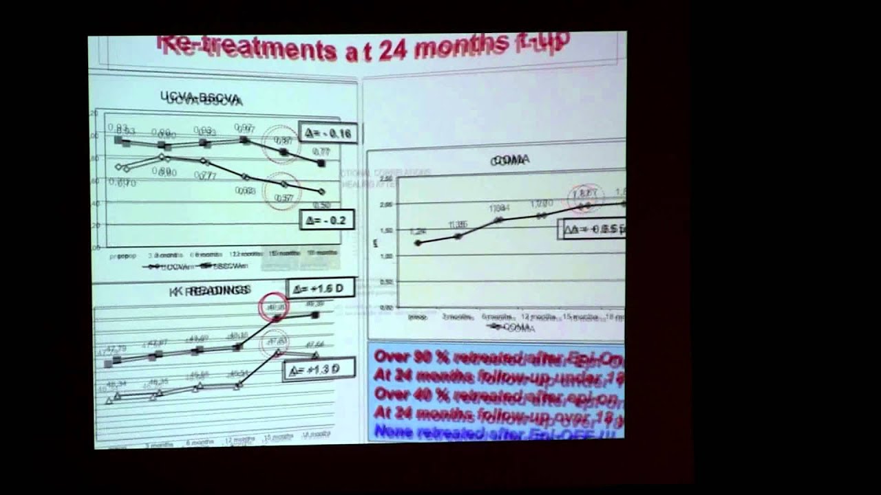 upload image Miguel Rechichi| Magna graecia University| Italy| Ophthamology 2014 | OMICS International