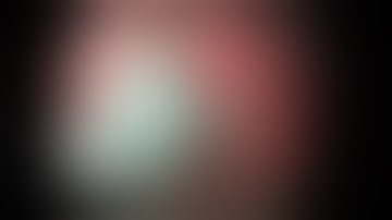 ESD of a gastric carcinoid