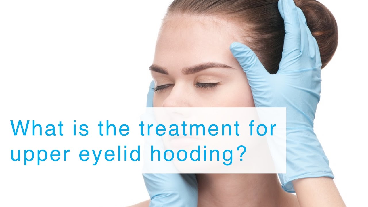 What is the treatment for upper eyelid hooding? YouTube