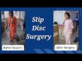 Slip disc surgery happy patient testimonial disc prolapsedisc herniation lumbar pivd operation