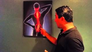 sciatic pain explained