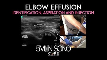Elbow Effusion - Identification, Aspiration and Injection