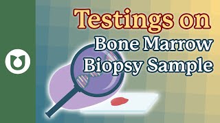 Inside a Myeloma Bone Marrow Biopsy: The Genetic Tests That Guide Treatment in Myeloma