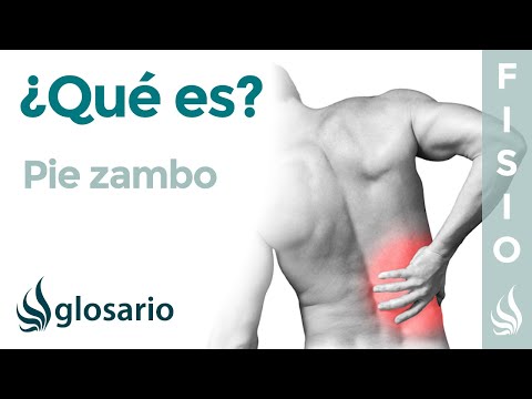 Vídeo: Pie Zambo: Causas, Síntomas Y Diagnóstico