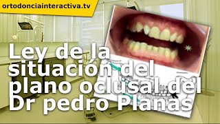 Ley de la situacion del plano oclusal del Dr. Pedro Planas