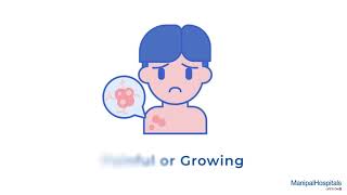 Lipoma Excision | Lipoma Excision Procedure | Manipal Hospitals India