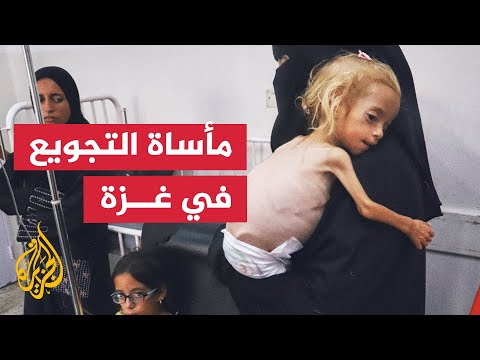 تقرير أممي يحذر من تفاقم مأساة التجويع في غزة ويطلق ناقوس خطر عاجل