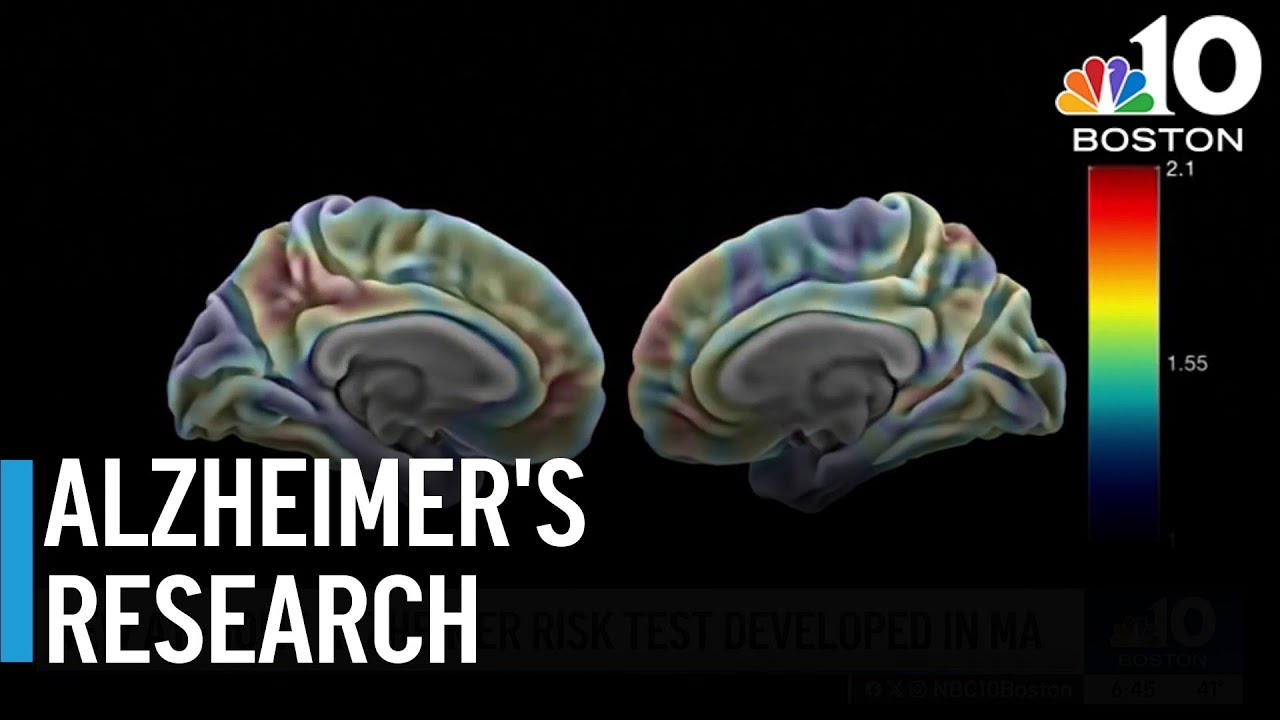 New at-home smell test could help determine risk of Alzheimer's