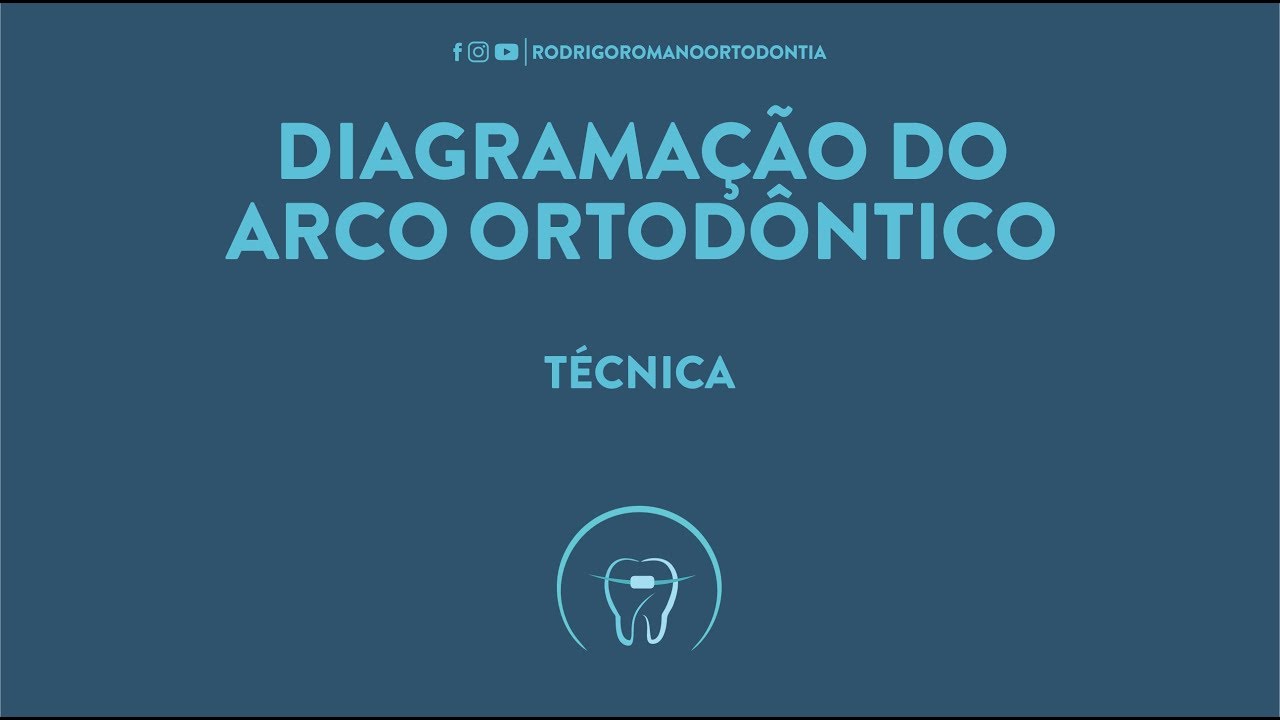 Diagramação dos Arcos Ortodônticos - Técnica