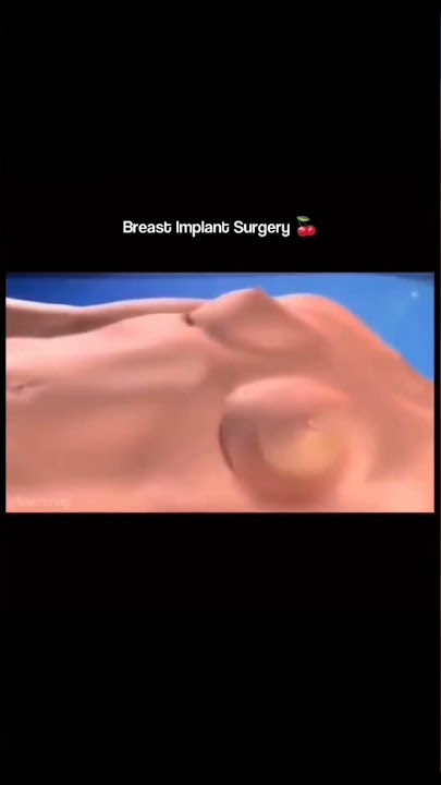 breast surgery #shorts #anime