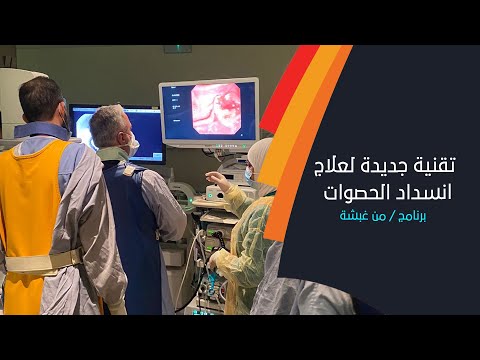 المستشفى السلطاني يستخدم تقنية جديدة لعلاج انسداد الحصوات في القنوات الصفراوية تعرف على التفاصيل