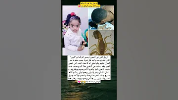 رجل يفقد ابنته التي التحقت بأهلها بعد لدغة عقرب حسبنا الله ونعم الوكيل 