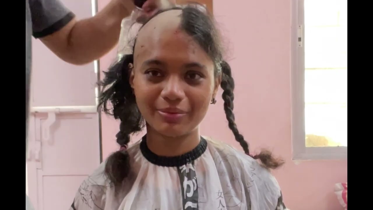 Full Story of bald Beauty| 