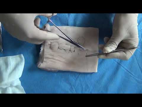外科缝合及拆线Surgical suture and suture removal