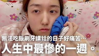 【ChanelWang】 我人生中最慘的一週.... ［拔智齒全記錄］