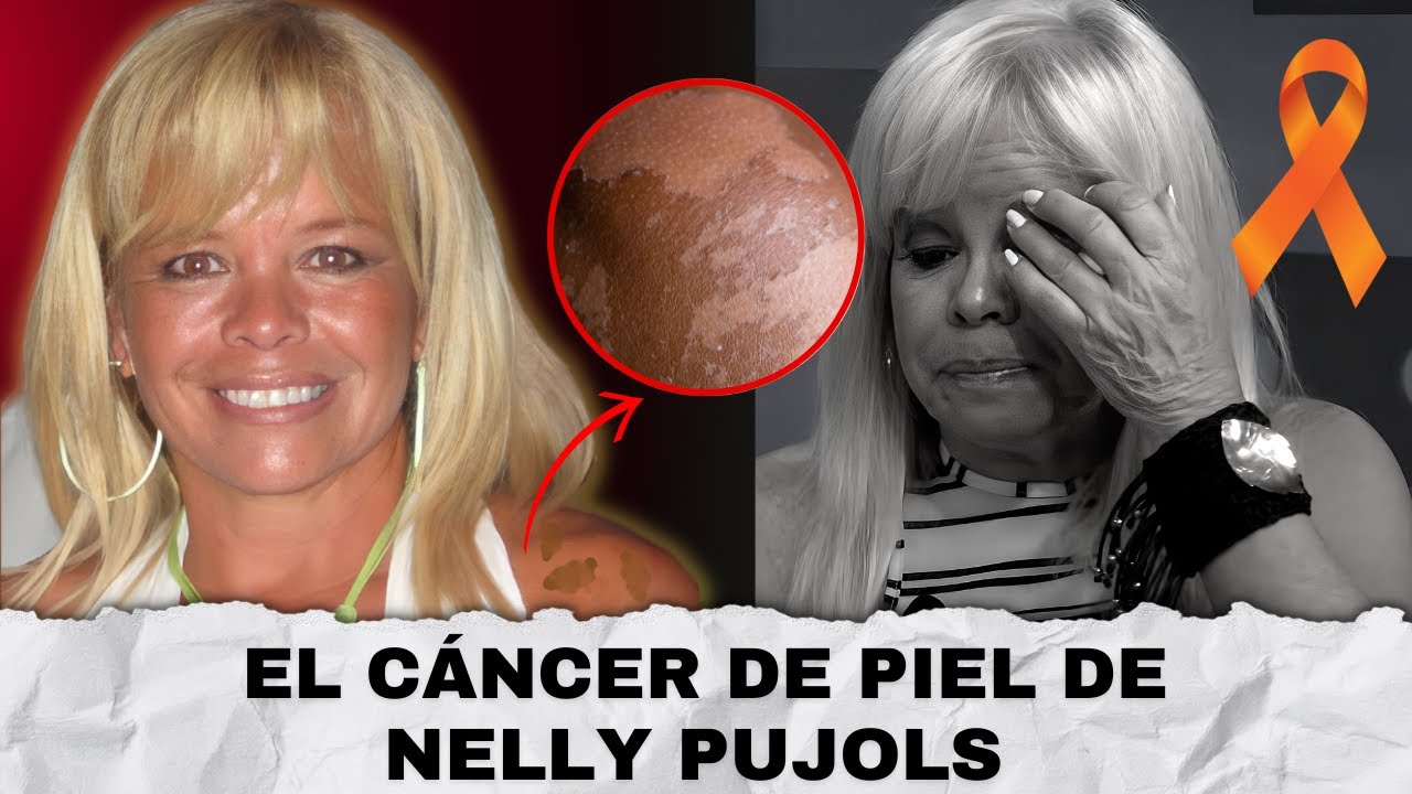 ASÍ LE CAMBIÓ LA VIDA A LA COMEDIANTE NELLY PUJOLS