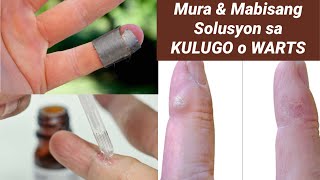 PAANO MAWALA ANG KULUGO O WARTS In 1 WEEK? | SOLUSYON SA KULUGO O WARTS PAANO MAWALA ANG KULUGO O WARTS In 1 WEEK? | SOLUSYON SA KULUGO O WARTS