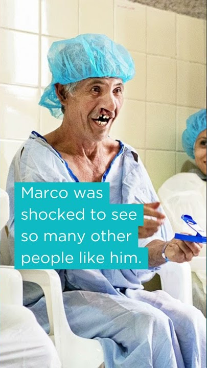 Marco's Story