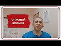 Чем опасен сколиоз?