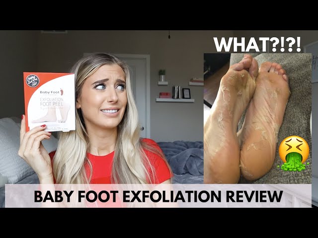 ET Style's HONEST Review of Baby Foot 