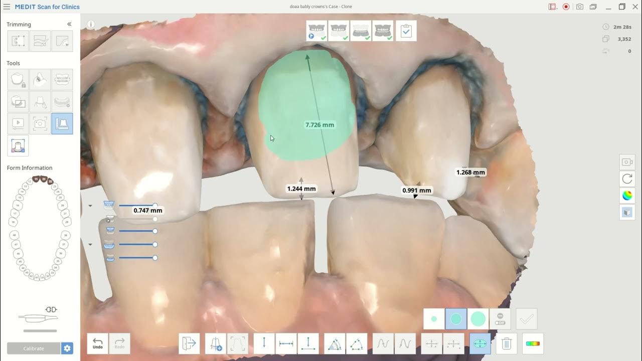 Medit scan software tutorials. The Measurement tool. Arabic commentary