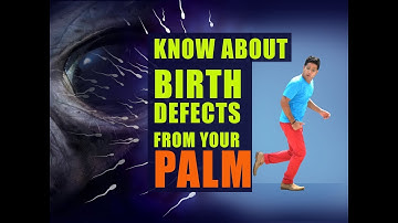 YOUR UNIQUE IDENTITY (FINGERPRINTS) & BIRTH DEFECTS