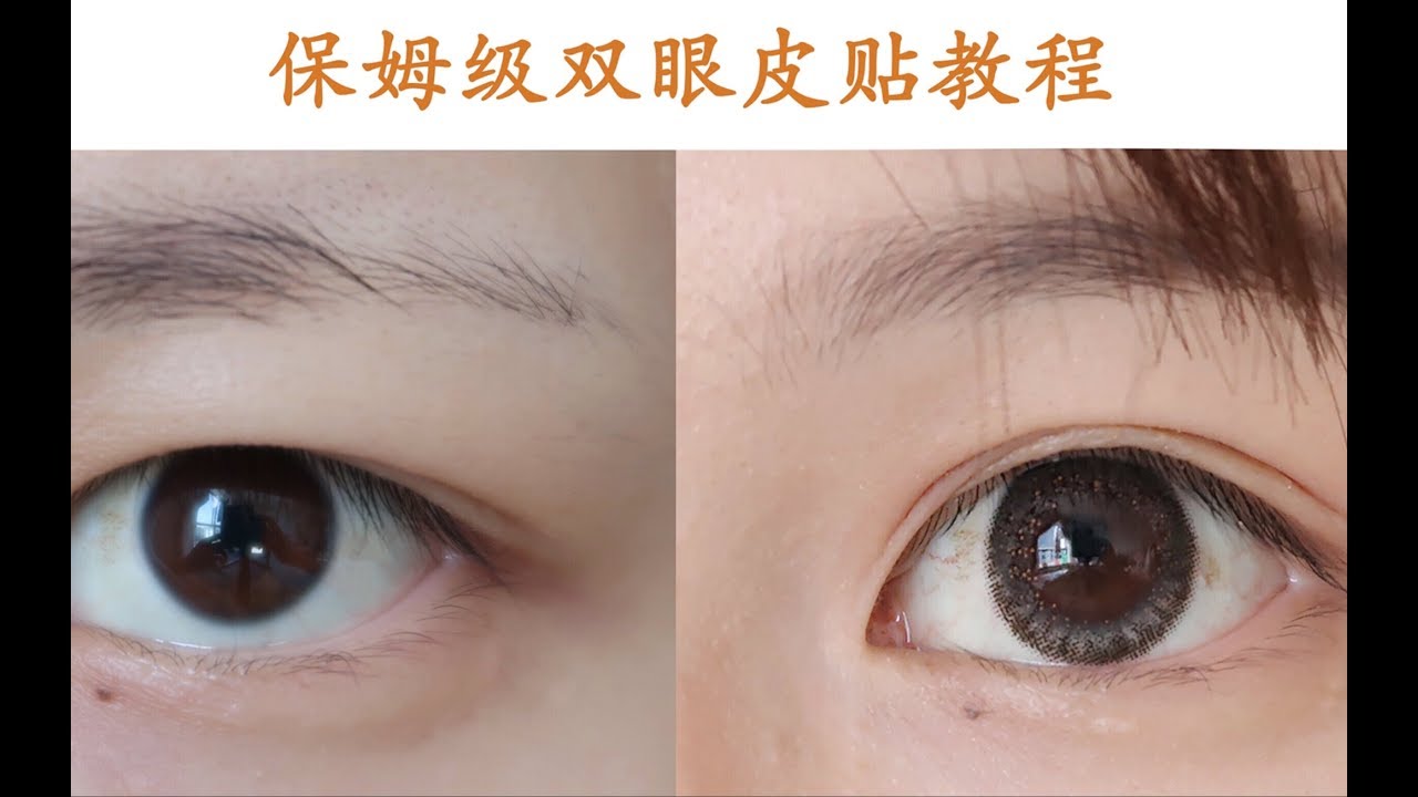 肿眼泡内双必看 十年双眼皮贴之路 肿眼泡 厚眼皮 肿内双是怎么贴出自然的双眼皮多种双眼皮贴分享