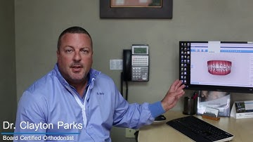 The Power of Invisalign Technology