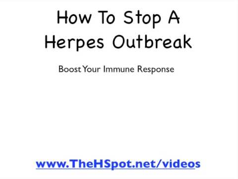 Como parar um Herpes Outbreak
