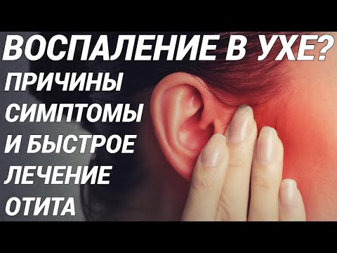 ОТИТ - ВОСПАЛЕНИЕ УХА: симптомы, причины, лечение! Как определить вид отита и правильно лечить?