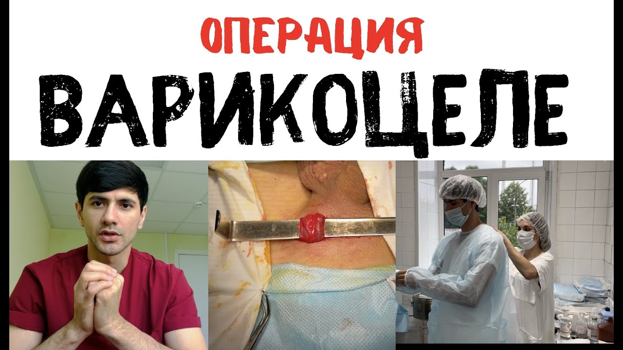 ОПЕРАЦИЯ!!! Варикоцеле!!!( субингвинальная Микрохирургическая ...