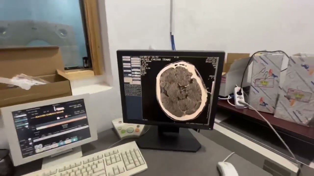 والي سعيدة يفاجئ عمال وموظفي مستشفى احمد مدغري.. غياب التدفئة وجهاز سكانير معطل !