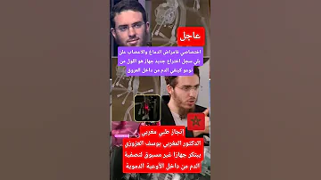إنجاز طبي مغربيالدكتور المغربي يوسف العزوزي يبتكر جهازا غير مسبوق لتصفية الدم من داخل الأوعية 