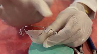 Activation of Labial Bow (Malayalam)
