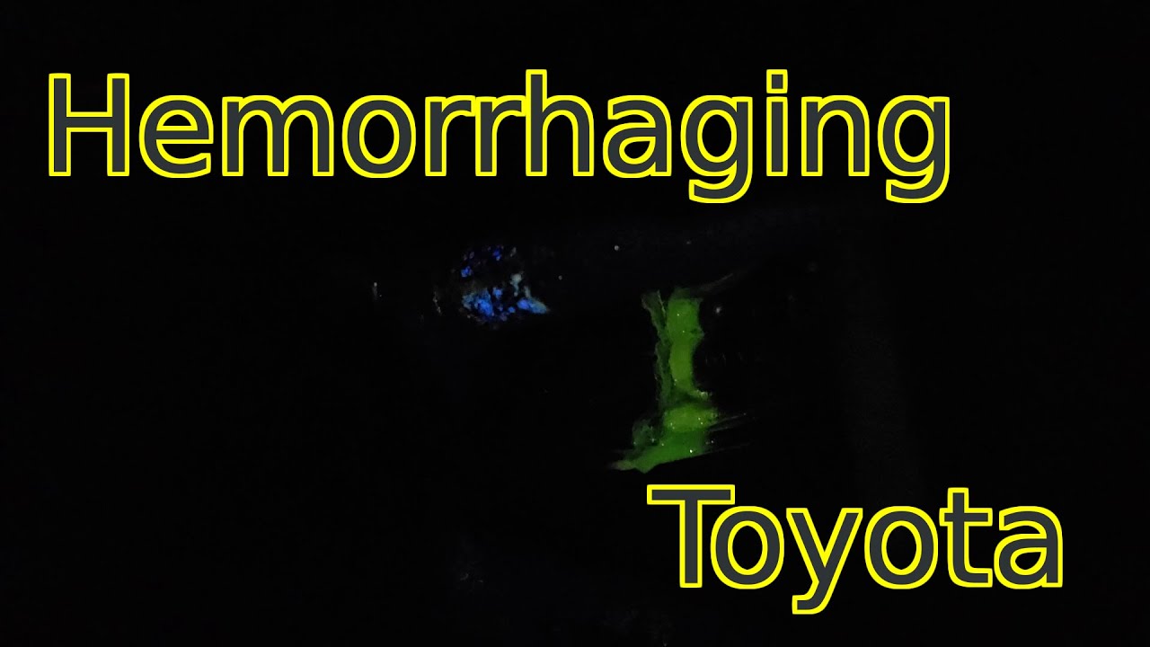 What a bad engine oil leak looks like with UV dye YouTube